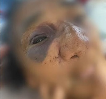 idosa_de_88_anos_agredida