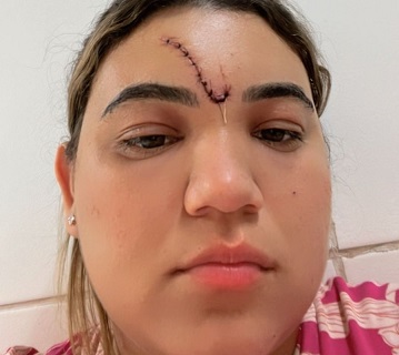 golpes_de_faca_no_rosto