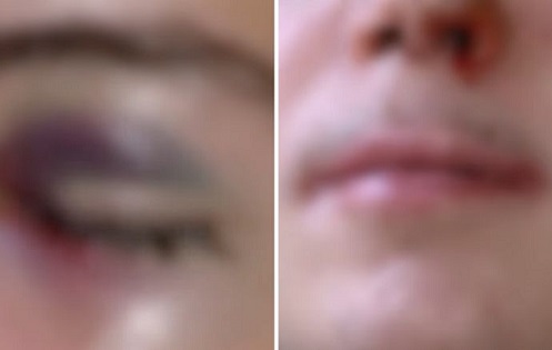 adolescente_agredido_em_escola_estadual