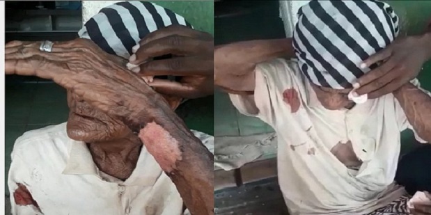 iacu-idosa_agredida_em_assalto